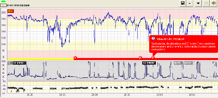 SisPorto Alert with ST-Event